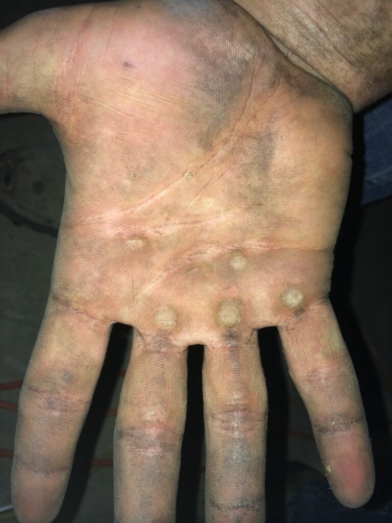Hands on work